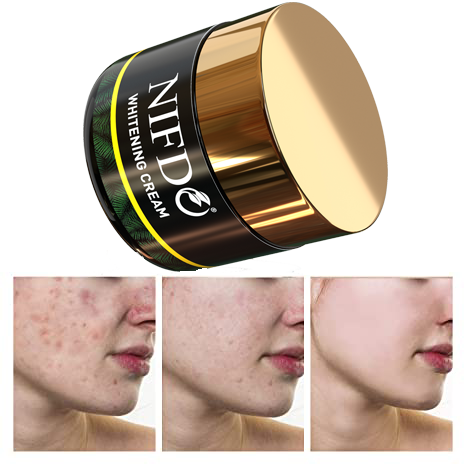 Skin Whitening Cream in Pakistan